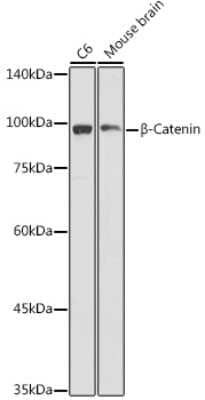 Western Blot: beta-Catenin Antibody [NBP2-92970] - Western blot analysis of extracts of various cell lines, using beta-Catenin antibody (NBP2-92970) at 1:1000 dilution. Secondary antibody: HRP Goat Anti-Rabbit IgG (H+L) at 1:10000 dilution. Lysates/proteins: 25ug per lane. Blocking buffer: 3% nonfat dry milk in TBST. Detection: ECL Basic Kit. Exposure time: 3s.